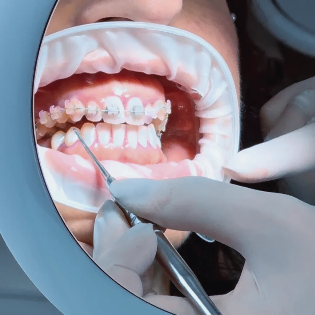 Igiene dentale a Mozzecane