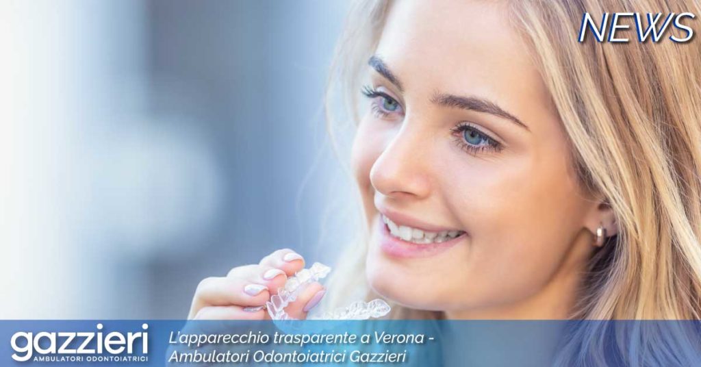 Apparecchio trasparente a Verona | Ambulatorio Odontoiatrico Gazzieri