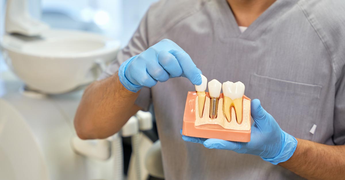 implantologia dentale verona gazzieri