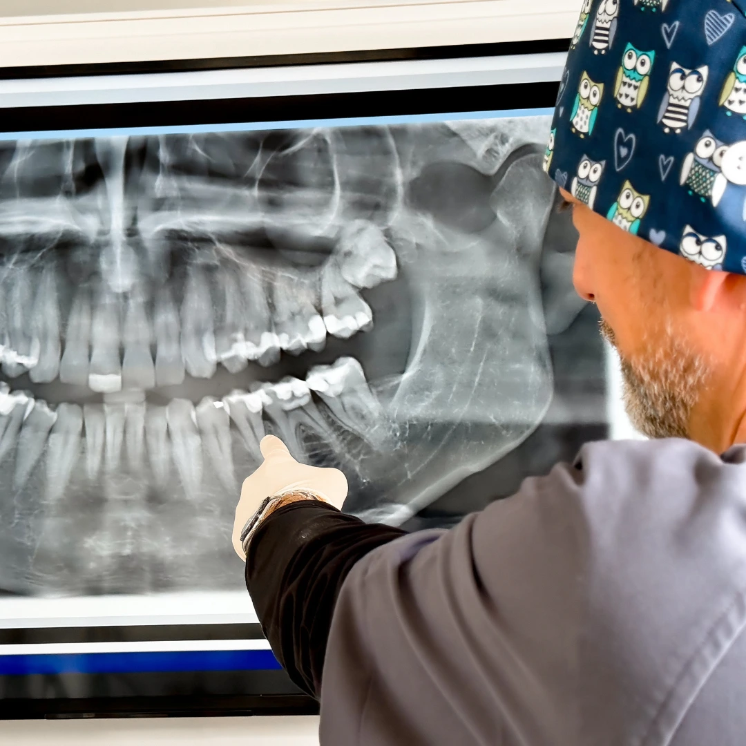 Otturazioni a Mozzecane - Studio dentistico a Valeggio sul Mincio