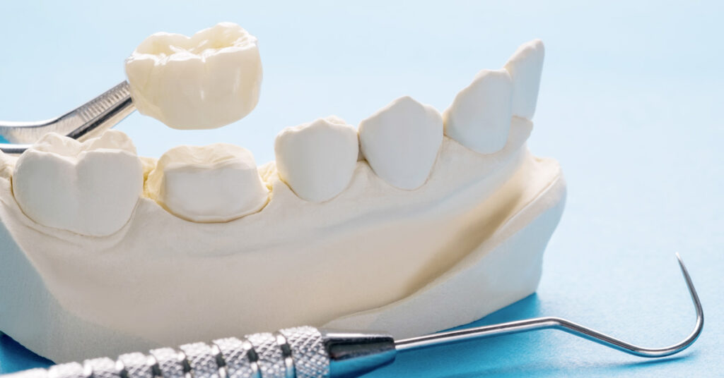 zirconia