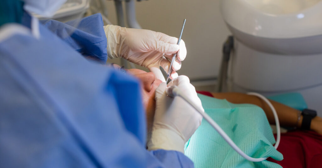 gazzieri smalto dentale