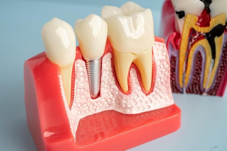 glossario implantologia a mozzecane
