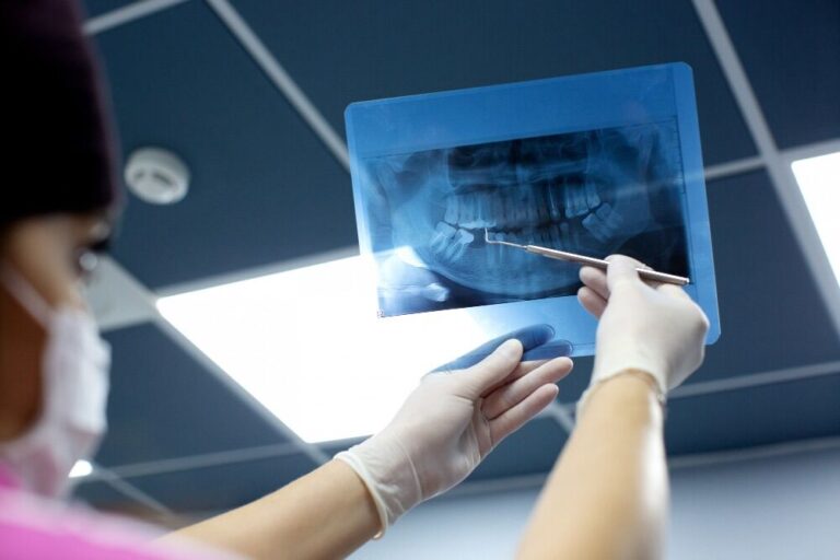 tecniche di implantologia dentale moderna