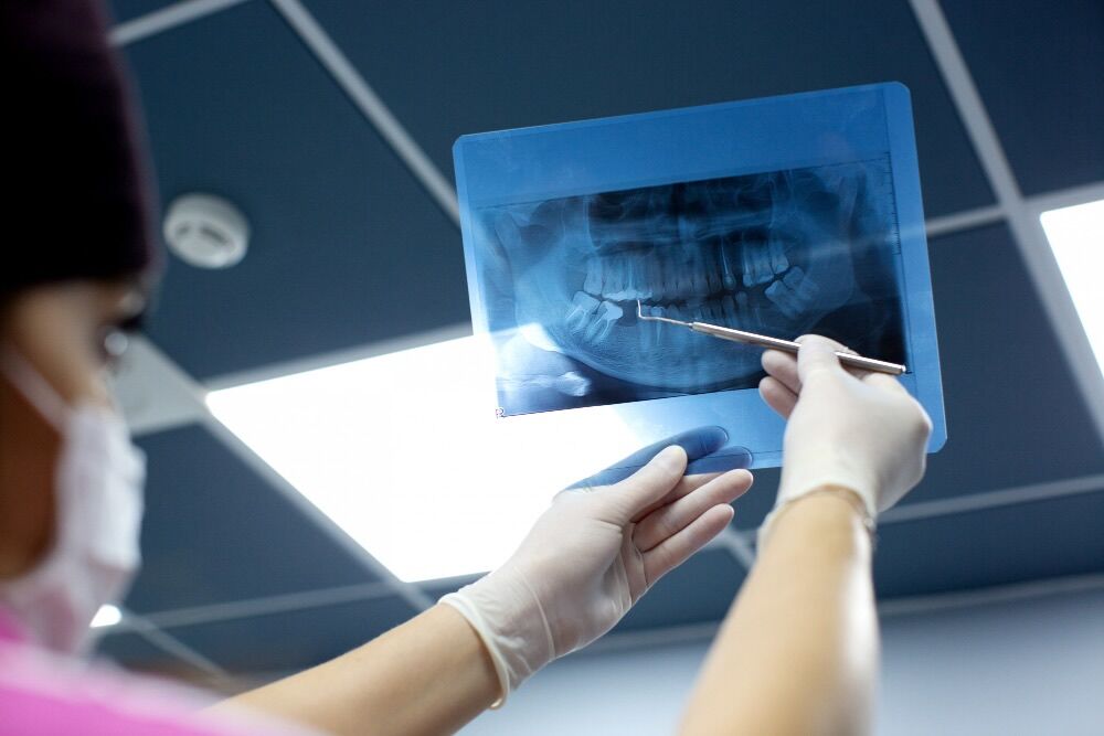tecniche di implantologia dentale moderna